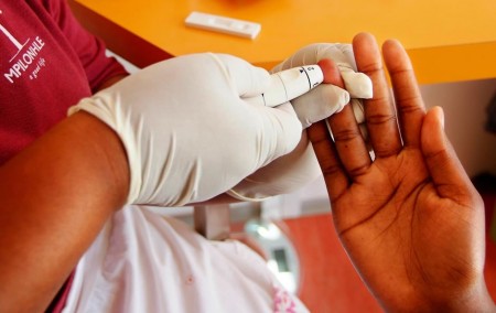 HIV & AIDS Testing