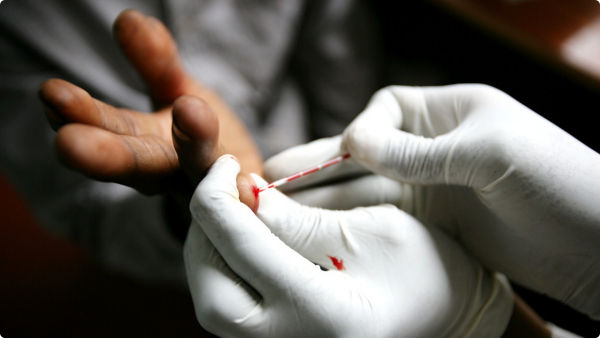 HIV Tests